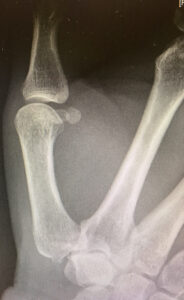 North West Orthopaedic Association